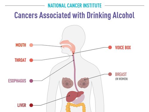 National Cancer Institute