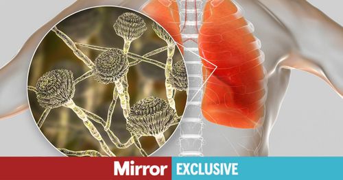 Daily Mirror